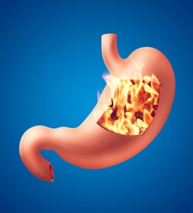 Photorealistic illustration of human stomach with heartburn disease